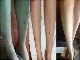Imagem do Peeling Resorcina 50% 30ml + Sabonete Pré E Pós Peeling 60ml