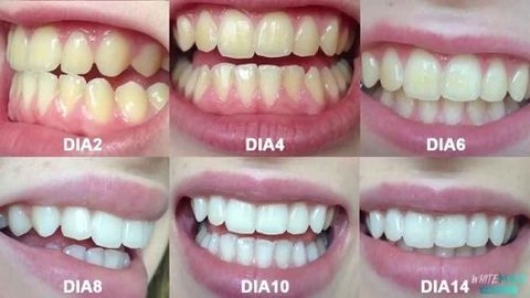 Clareador Dental Para Fumantes. 10g - comprar online