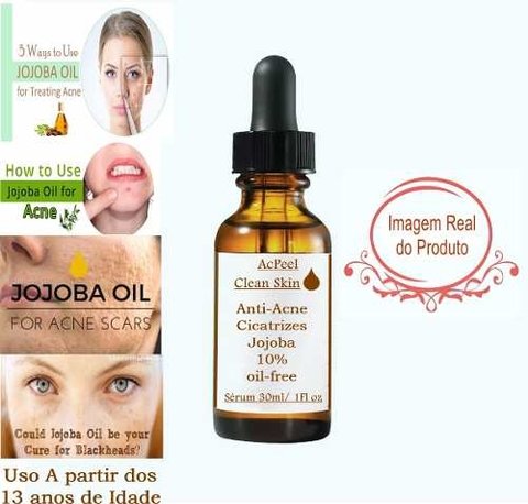 Ácido Retinoico 3% Salicílico 5% + Sabonete 60ml + Jojoba na internet