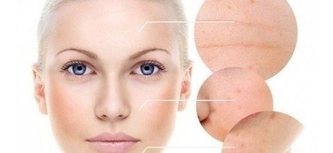 Sabonete Ácido Hidroquinona 30%( Acne, Manchas Rugas)200ml - Clean Face Skin