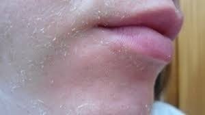 Ácido Retinóico 50% Puro Profissional + Sabonete Peeling - Clean Face Skin