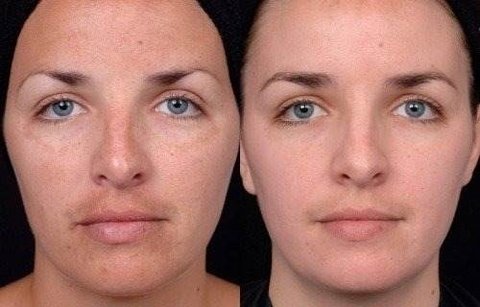 2 Vitaminas C 30% 30ml + Sabonete Pré E Pós 60ml - loja online