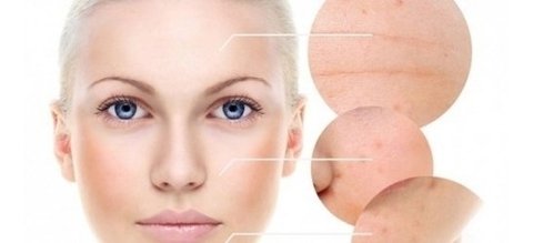 Imagem do Ácido Hialurônico 50% Rejuvenescedor Facial Solução 30ml