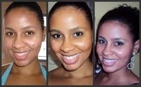 Ácido Retinóico 30% Profissional + Sabonete Peeling 60ml