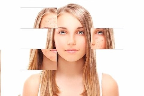 Ácido Glicolico 20% 30ml +2 Sabonetes Pré Peeling 110ml na internet