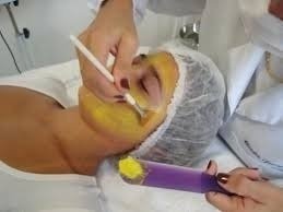 Ácido Retinóico 10% Ácido Kojico 10% + Sabonete 60ml na internet