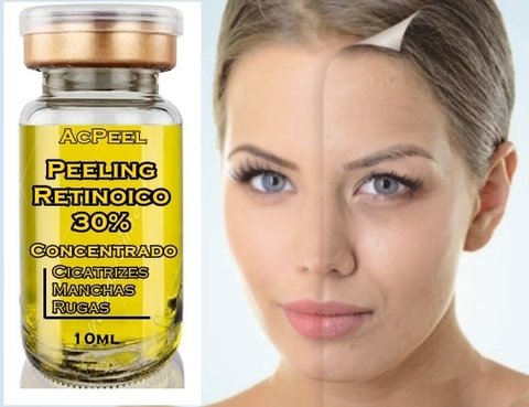 Ácido Retinóico 30% Peeling Profissional + Sabonete 60ml