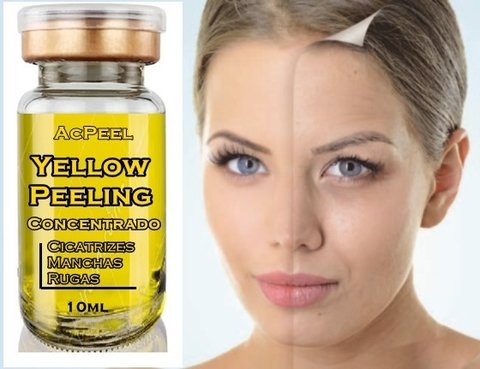 Ácido Yellow Peeling - Associação Poderosa + Sabonete