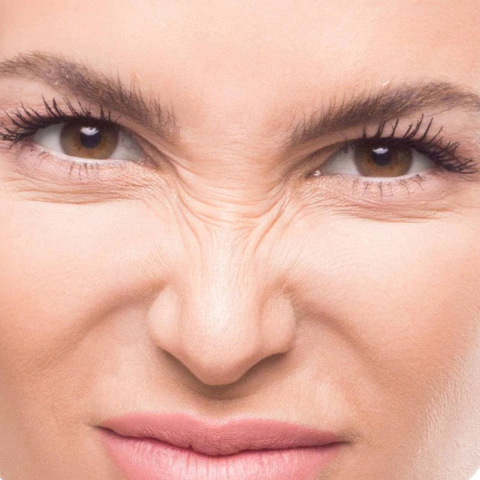 BUNNY LINES (Líneas de conejo )