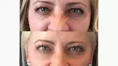 BUNNY LINES (Líneas de conejo ) - comprar online