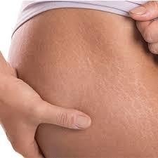 DERMAPEN x2 SESIONES (FACIAL) - - tienda online