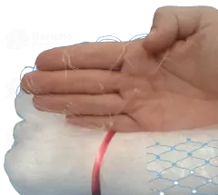 Panagem de Rede 0.30x37,5x48 Altura 3,6m