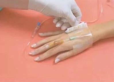 APOSITOS IV 3000 ADVANCE CLASSIC 10x12cm (con etiquet y refuerzo) SMITH & NEPHEW