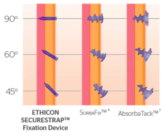 DISPOSITIVO SECURESTRAP 12 ETHICON JOHNNSON & JOHNNSON en internet