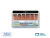 Conos de Guta Taper 02 x 120u Metabiomed - comprar online