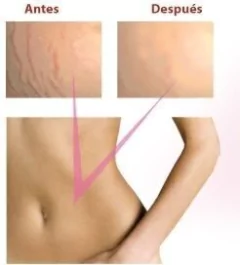 Aceite De Almendras Dulces 125ml 100% Puro en internet