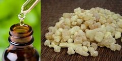 Aceite Esencial De Incienso Envase 15ml Villa Urquiza - Saiku Natural 