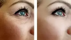 Contorno De Ojos Reparador Antiage Rejuvenecedor 30 Grs Villa Urquiza CABA (Oferta por tiempo limitado) - comprar online