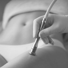 Peeling Mecánico Corporal