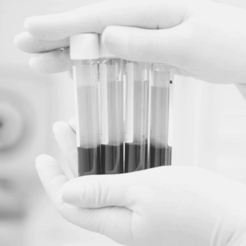 Plasma Rico en Plaquetas - comprar online