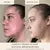 MARA - Niacinamide + Copper Clear Skin Mineral Milk Acne Treatment - tienda online