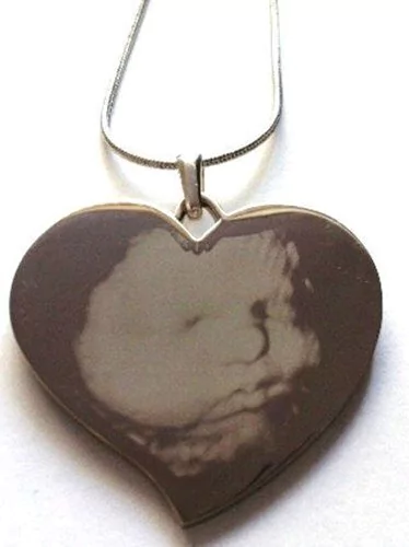 Ecografia Foto Medalla Llavero Ó Cadena Baby Shower