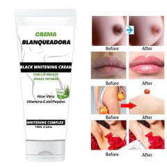 Crema Blanqueadora Cuello Cavado Axila Pezon Agnovedades en internet