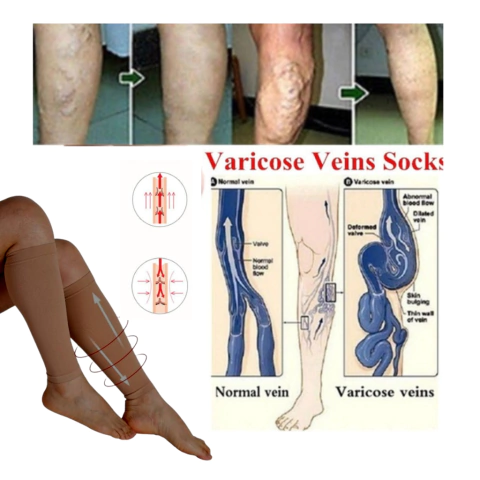 Pantorrilla Media Varices Gemelos Compresión Agnovedades - AGNOVEDADES