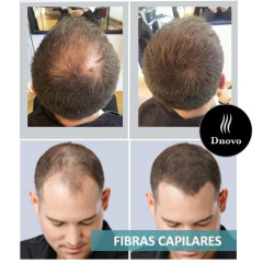 Imagen de Fibras Capilares Agnovedades 60 dias Envase Generico