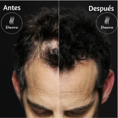Fibras Capilares Agnovedades 60 dias Envase Generico en internet