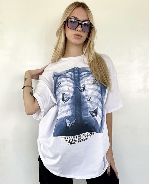 REMERON PULMON MARIPOSAS (SIN CAMBIO)