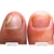 Micozione - fortalecedor e reparador de unhas - 10ml - Biozenthi