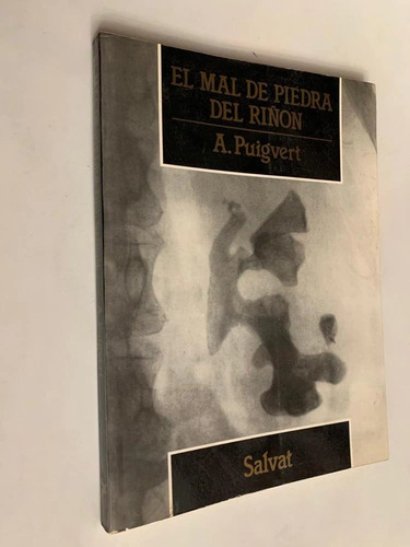 El mal de piedra del riñón - A. Puigvert