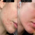 Crema Noche Acne Clearing Moisturizer The Inkey List - Ifans - iFans
