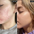 Serum De Niacinamida 10% Tratamiento The Inkey List - Ifans - iFans