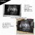 Quadro Decorativo - Ponte P/B luzes amarelas cod0042 na internet
