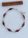 Pulseira Em Prata 925 Com Rubi (53/25U1390319)