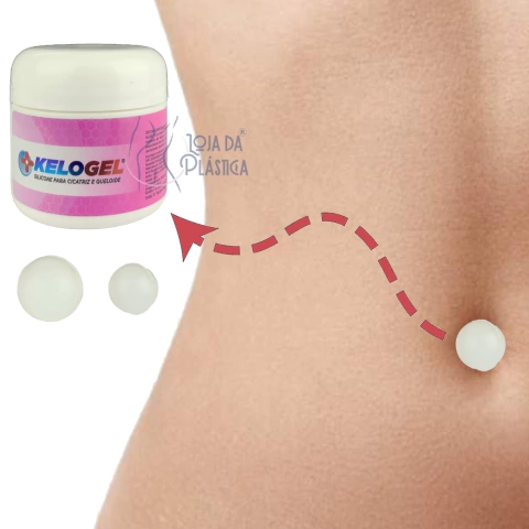 Órtese Umbigo Silicone Pérola Pós Cirurgia Plástica Kelogel