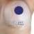 Fita T Invertido Gel De Silicone Cicatriz Mama 2un Kelogel na internet