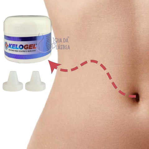 Órtese De Umbigo Anatômica Cirurgia Plástica Kelogel 02 Un