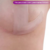Fita Para Cicatriz Queloide Gel Silicone Em L Mama Siliskin