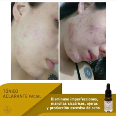 TÓNICO ACLARANTE CLASS GOLD PARA EL ROSTRO 25ML Ó 50ML - tienda online