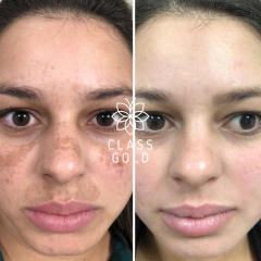 TÓNICO ACLARANTE CLASS GOLD PARA EL ROSTRO 25ML Ó 50ML en internet