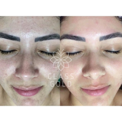 Imagen de TÓNICO ACLARANTE CLASS GOLD PARA EL ROSTRO 25ML Ó 50ML