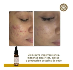 Imagen de TÓNICO ACLARANTE CLASS GOLD PARA EL ROSTRO 25ML Ó 50ML