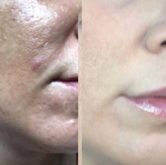 JABÓN FACIAL CLASS GOLD ANTIOXIDANTE PIEL GRASA 32GRS - Class Gold Cosmetics & Magic Hair Oficial