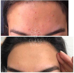 JABÓN FACIAL CLASS GOLD ANTIOXIDANTE PIEL MIXTA A SECA 32GRS - Class Gold Cosmetics & Magic Hair Oficial