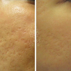 JABÓN FACIAL CLASS GOLD ANTIOXIDANTE PIEL GRASA 32GRS