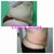 Lipolaser de 16 pad.