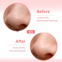 Cepillo Exfoliante Silicona + Vincha Spa + Esponja Blender - tienda online